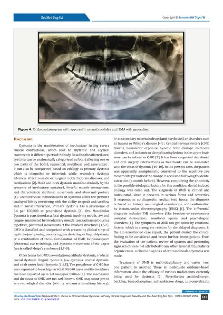 Can dystonia affect the mouth?