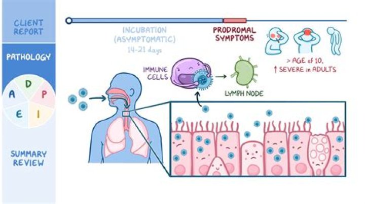 Can varicella pneumonia be cured?