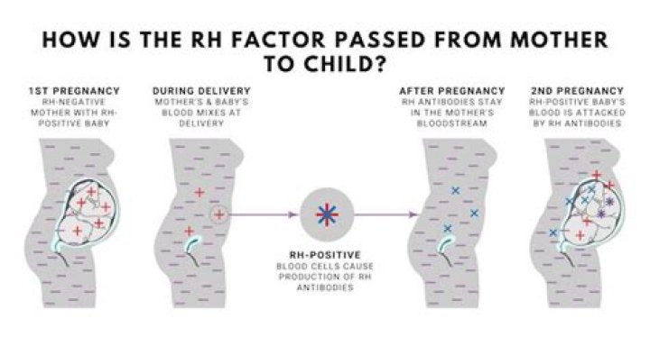 How does being Rh-negative affect second pregnancy?