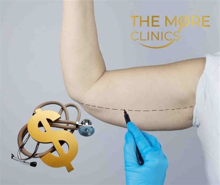 How much does arm tendon surgery cost?