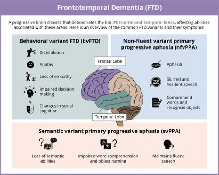 How quickly does frontotemporal dementia progress?