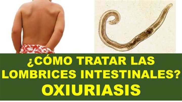 Por que salen lombrices por la boca?