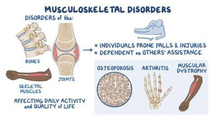 What are the symptoms of musculoskeletal disorders?