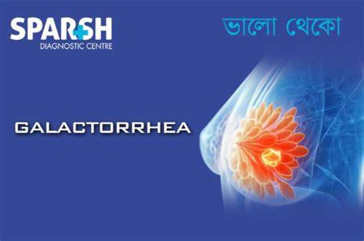 What causes galactorrhea?