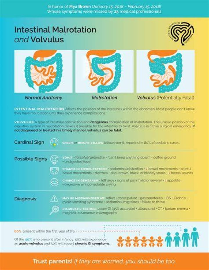 What causes malrotation of the intestines?