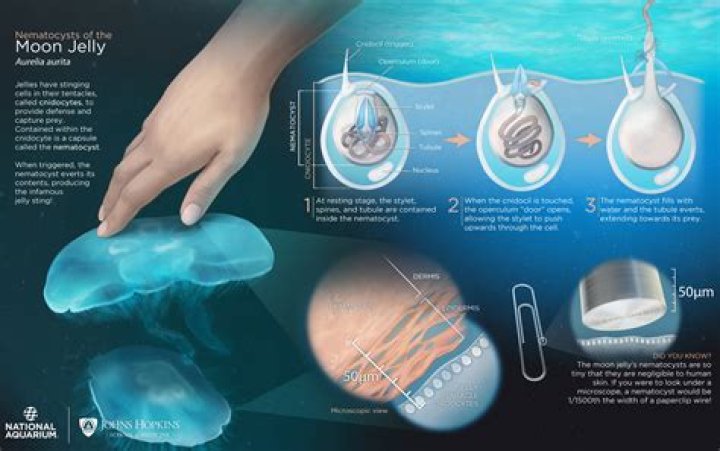What happens if you get stung by a moon jellyfish?