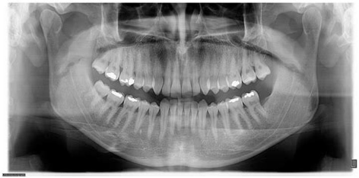 What is a panoramic radiographic image?